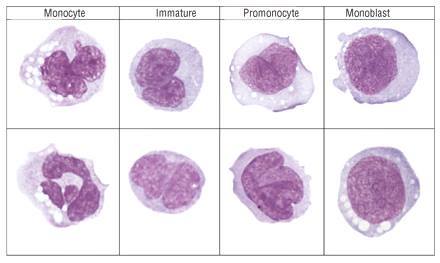 Kenmerken ontdekt van zeldzame kanker afweercellen | LUMC