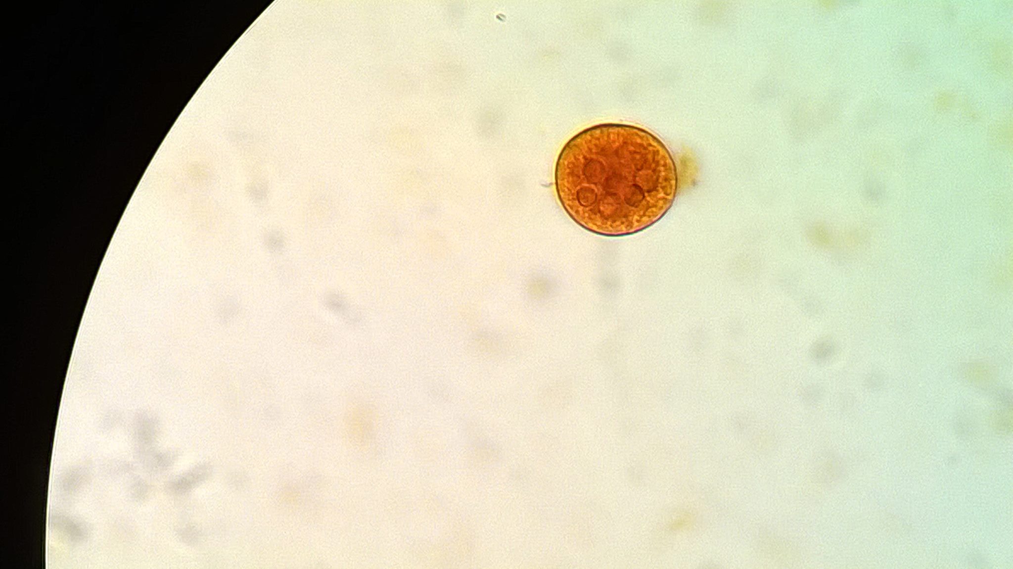Entamoeba coli в кале. Цисты Entamoeba. Цисты лямблий под микроскопом. Entamoeba coli циста. Цисты кишечной амебы (Entamoeba coli).