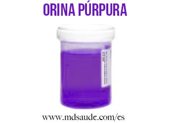 orina-purpura